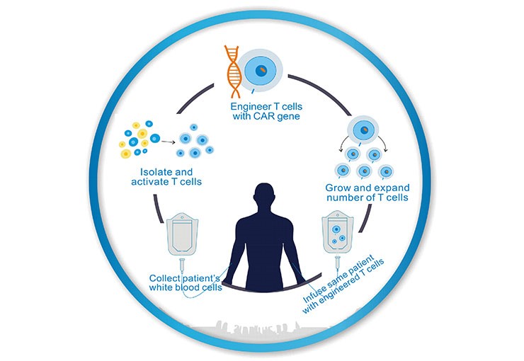 The Processes of CAR-T Cell Therapy