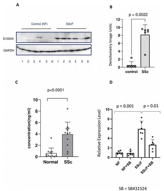 S100A4在系统性硬化症(SSc)成纤维细胞中的表达和释放