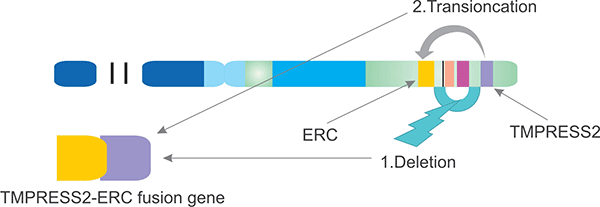 TMPRESS2-ERG融合机制(21号染色体)