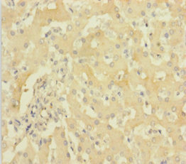 CSB-PA010155HA01HU IHC