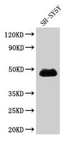 CSB-PA015409LA01HU