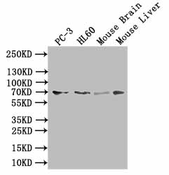 CSB-PA021704LA01HU