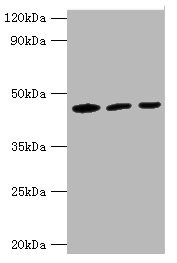 CSB-PA010989ESR1HU