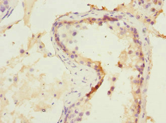 CSB-PA904948 IHC-1