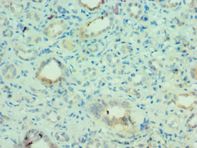 CSB-PA621968ESR1HU IHC