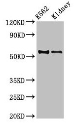 CSB-PA001566EA01HU