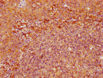 CSB-PA007690LA01HU IHC