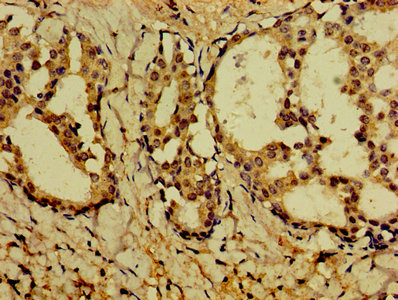 CSB-PA019092HA01HU IHC-1