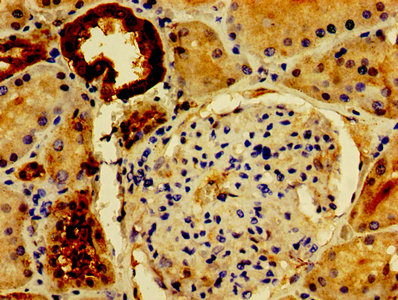 CSB-PA019092HA01HU IHC-2