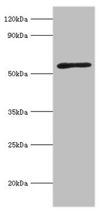 CSB-PA001260ESR2HU