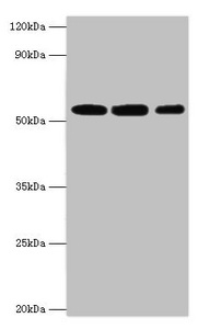 CSB-PA015422ESR2HU