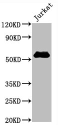 CSB-RA004935A0HU