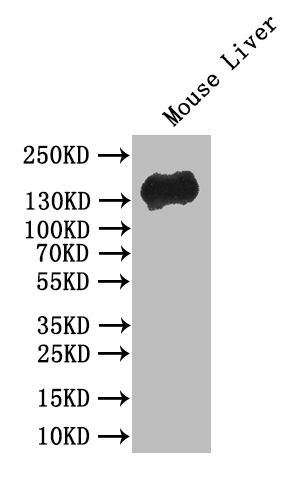 CSB-RA005034MA1HU WB