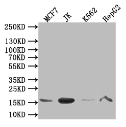 CSB-RA010418MA1HU WB