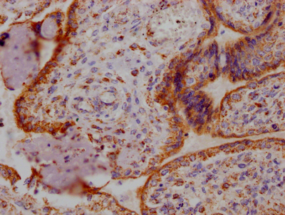 CSB-RA191985A0HU IHC