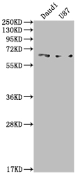 CSB-BP001262HU1 WB