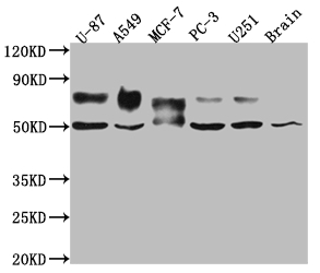 CSB-RA902876A0HU-WB