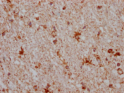 CSB-RA999377A0HU IHC-2