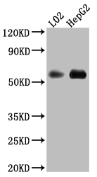 CSB-RA999377A0HU WB