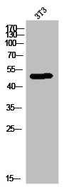 CSB-PA030137