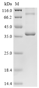 CSB-CF861476MO SDS