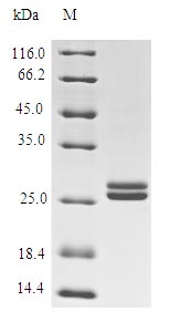 CSB-CF875009LNG-N SDS-page