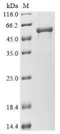 CSB-EP009956HU SDS-PAGE