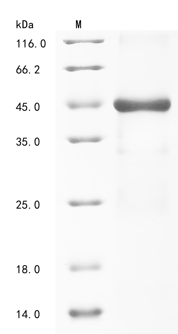 CSB-EP018085HU