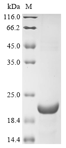 CSB-EP022654HU1