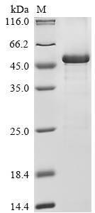 CSB-EP614961HU1