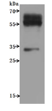 CSB-MP004848HU WB