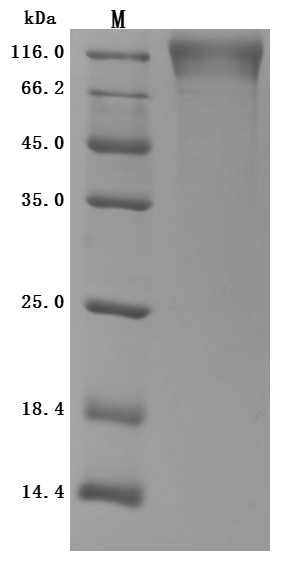 CSB-MP004971HU1(F2)-SDS