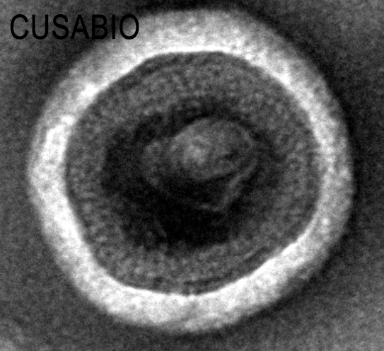 CSB-MP005508HU(A4) TEM