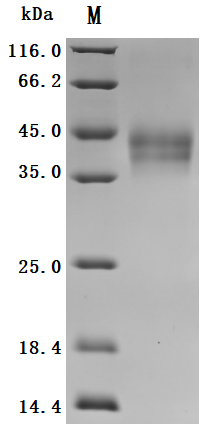 CSB-MP006920HU(A4) SDS-PAGE