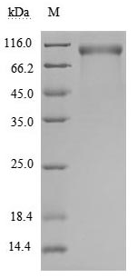 CSB-MP007763HU SDS-PAGE