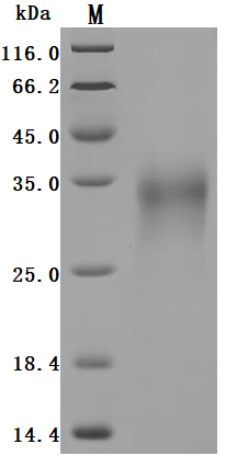 CSB-MP009514HUb1 SDS-PAGE