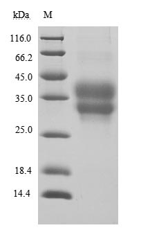 CSB-MP619964HU1 SDS-PAGE