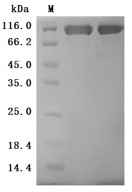 CSB-MP884474HU SDS-PAGE