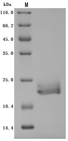 CSB-MP862025HUd9-SDS