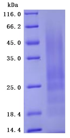 CSB-YP015318HU SDS-PAGE