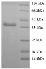 CSB-EP001936MO SDS-PAGE