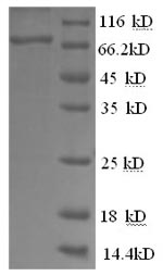 CSB-EP018986HU