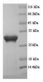 CSB-YP018751HU SDS-PAGE