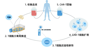 CAR-T细胞治疗开发解决方案