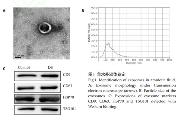 羊水外泌体鉴定