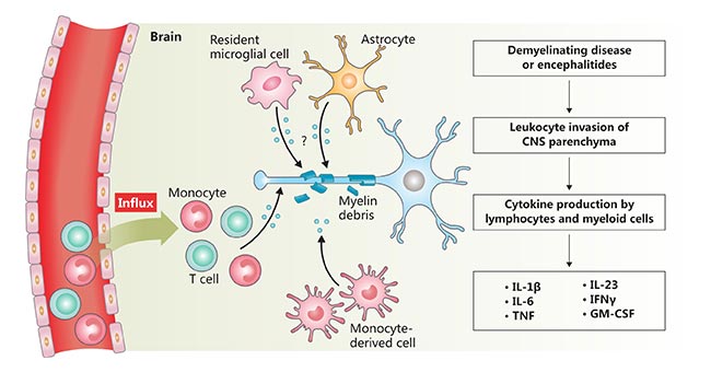 神经炎症的示意图