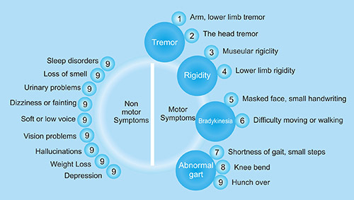 帕金森病的症状